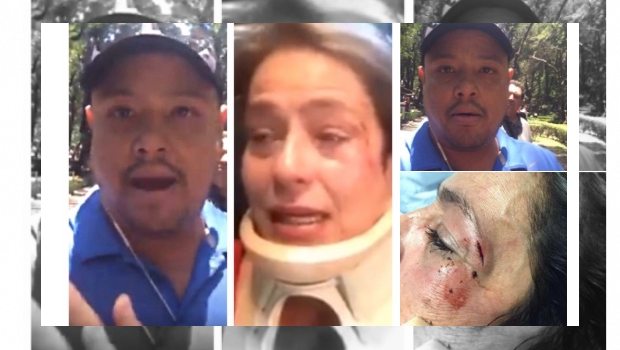 1018_mujer-atacada-en-parque-mexico_620x350