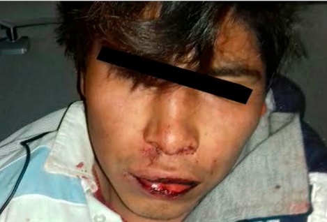 Detenido-noticias-Toluca-Metepec