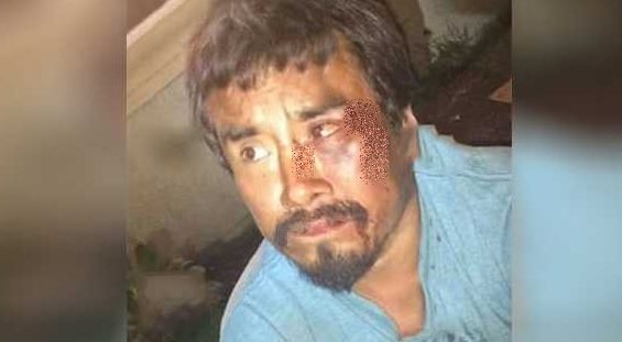 Ladrón-alarmas-Toluca-vigilancia