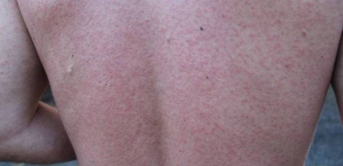 uploads_posts_41261f6d11e817ba7fa76fe1560949a4-700x340