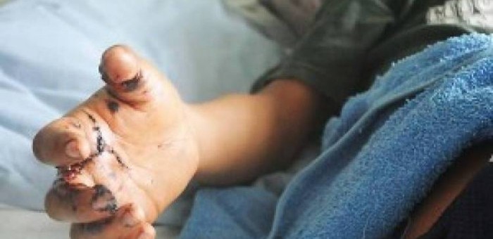 uploads_posts_be68ecddc41260550121842c8c6aae6a-700x340-2