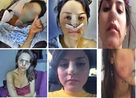 atencion-hospital-mujer